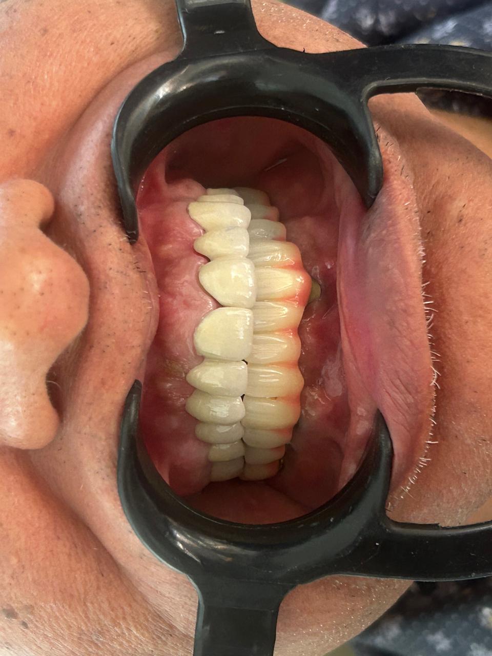 After cosmetic dentistry