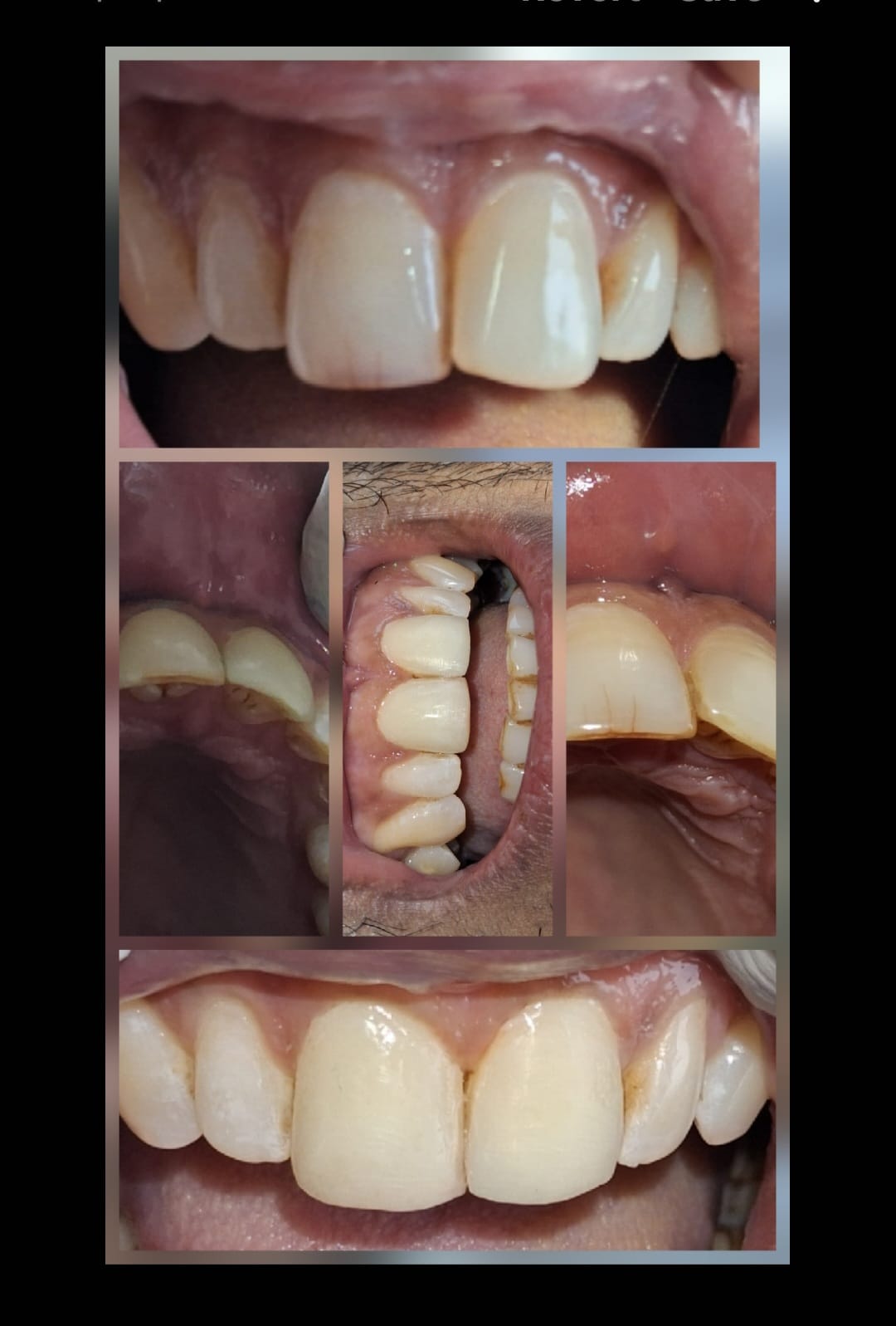 Smile transformation case study